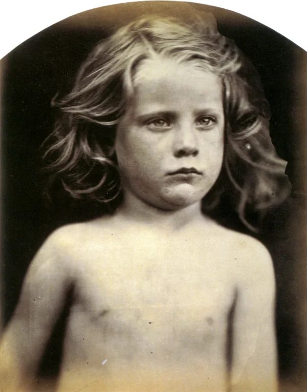 Young Astyanax Portrait