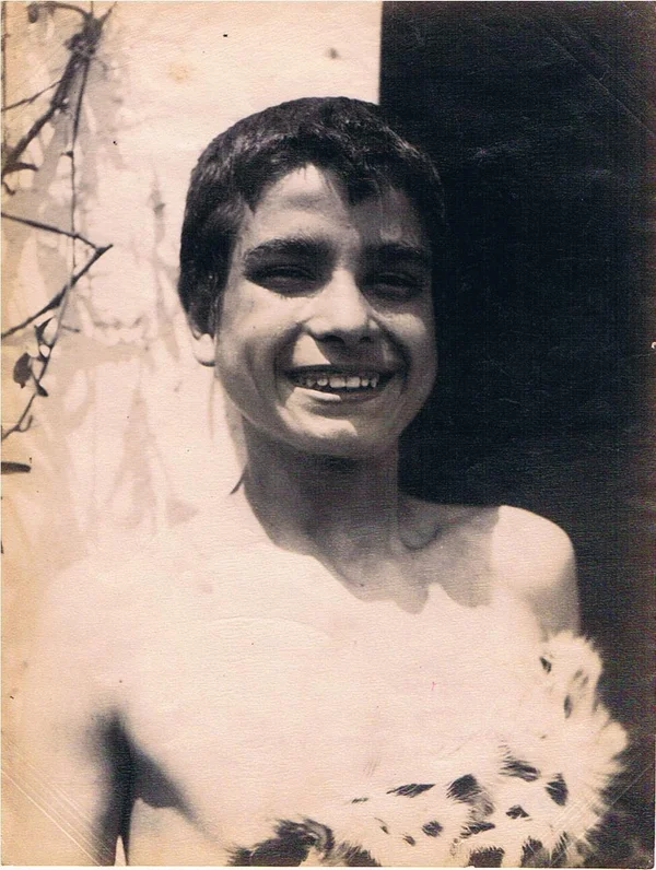 torso-of-boy-with-ghepard-fur male